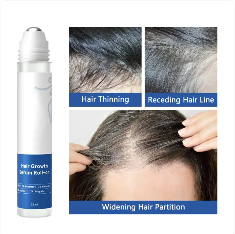 Hair Growth Roll On Serum